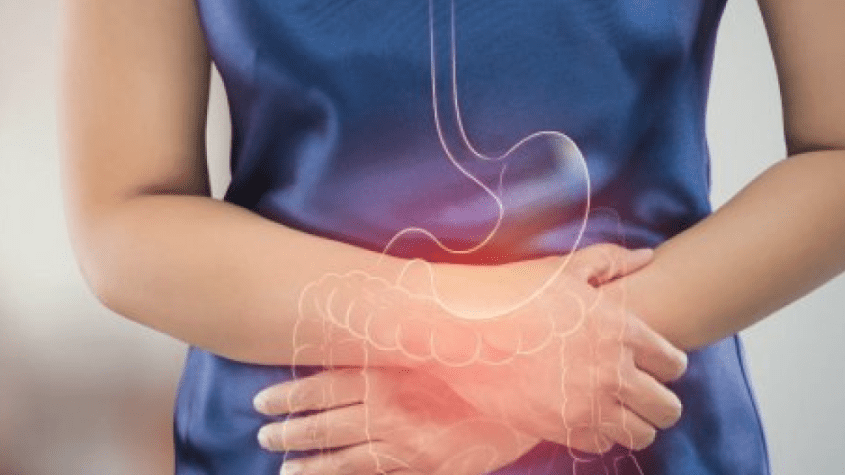 أعراض القولون العصبي عند النساء