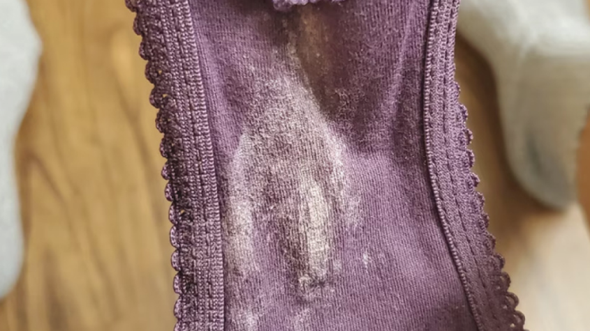 نزول الماء من المهبل بكثرة للمتزوجه الغير حامل