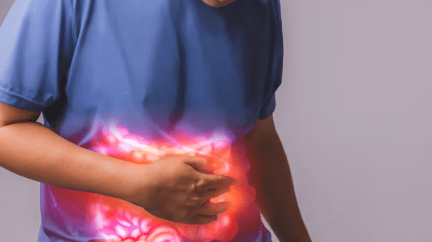 أعراض القولون العصبي عند الرجال