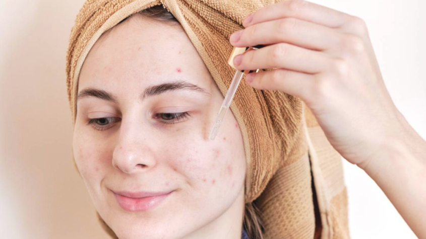 فوائد زيت الزيتون للبشرة الدهنية