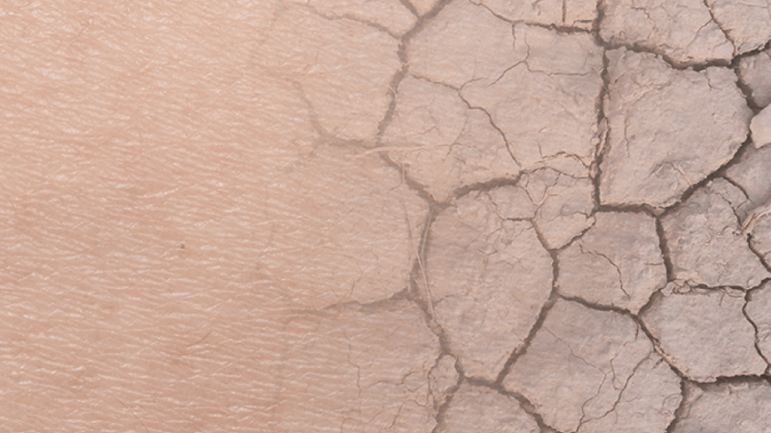 أسباب جفاف البشرة